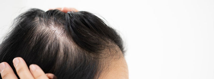 Why Women Lose Hair in Midlife